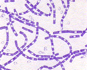 Microscopiebeeld Bacillus anthracis